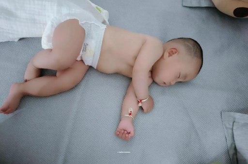 上饶六个月宝宝眼睛散光